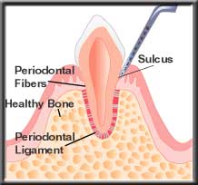 diagram of healthy tooth and gums